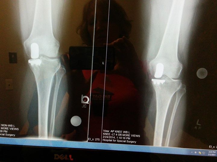 Patient image of: Krystina Keller