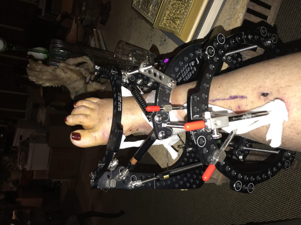 Patient image of: Meryl Zalkin