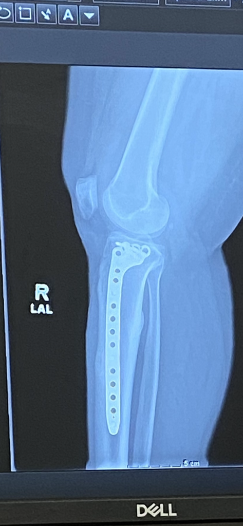 Patient image of: Leslie Colon