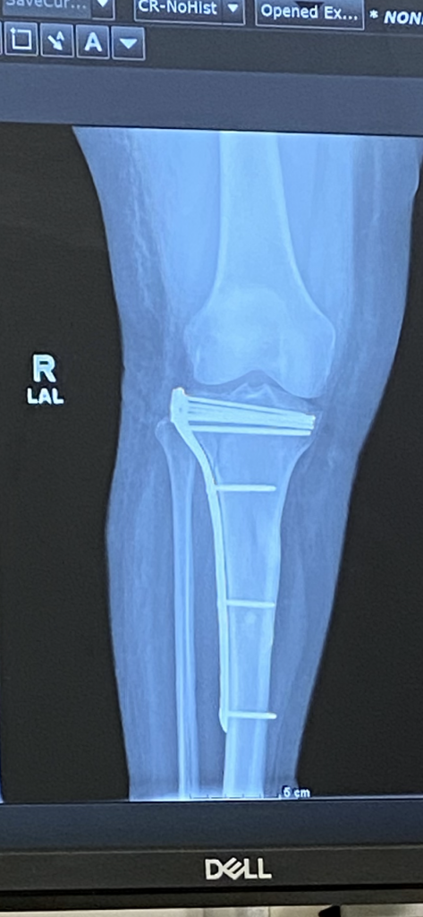 Patient image of: Leslie Colon