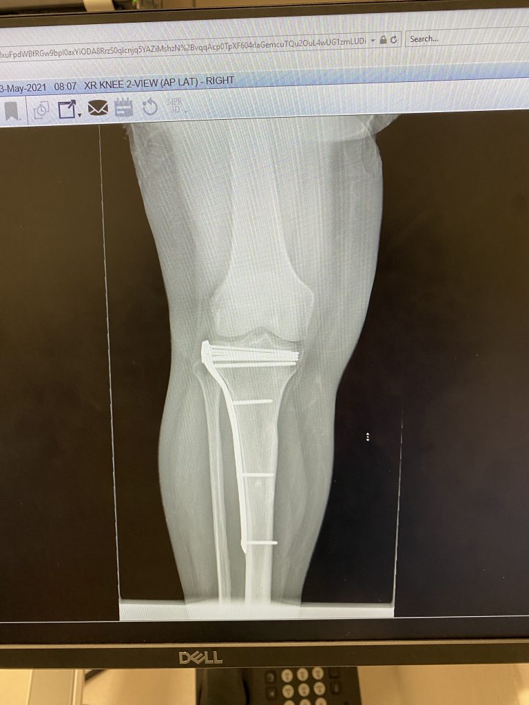 Patient image of: Leslie Colon