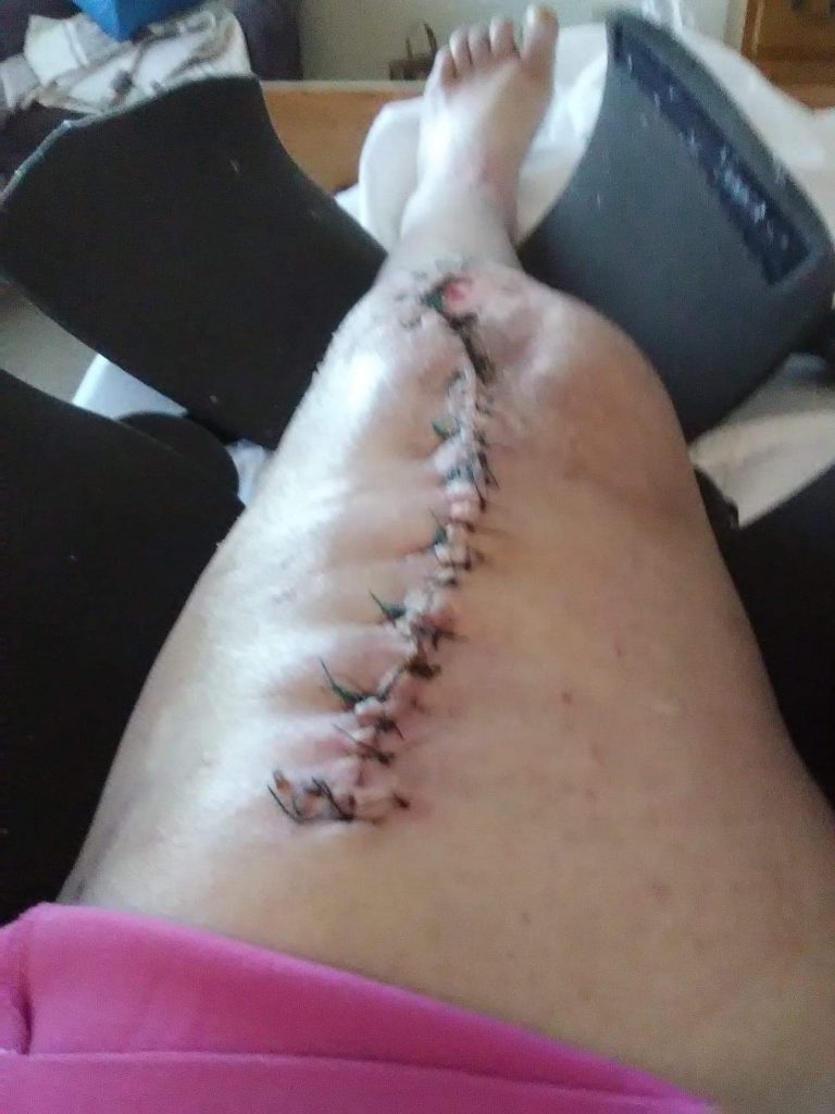 Patient image of: Michelle Stack