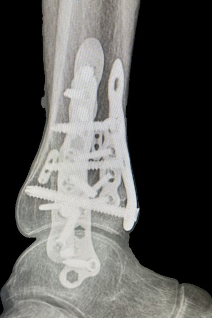Patient image of: Robin Belsky