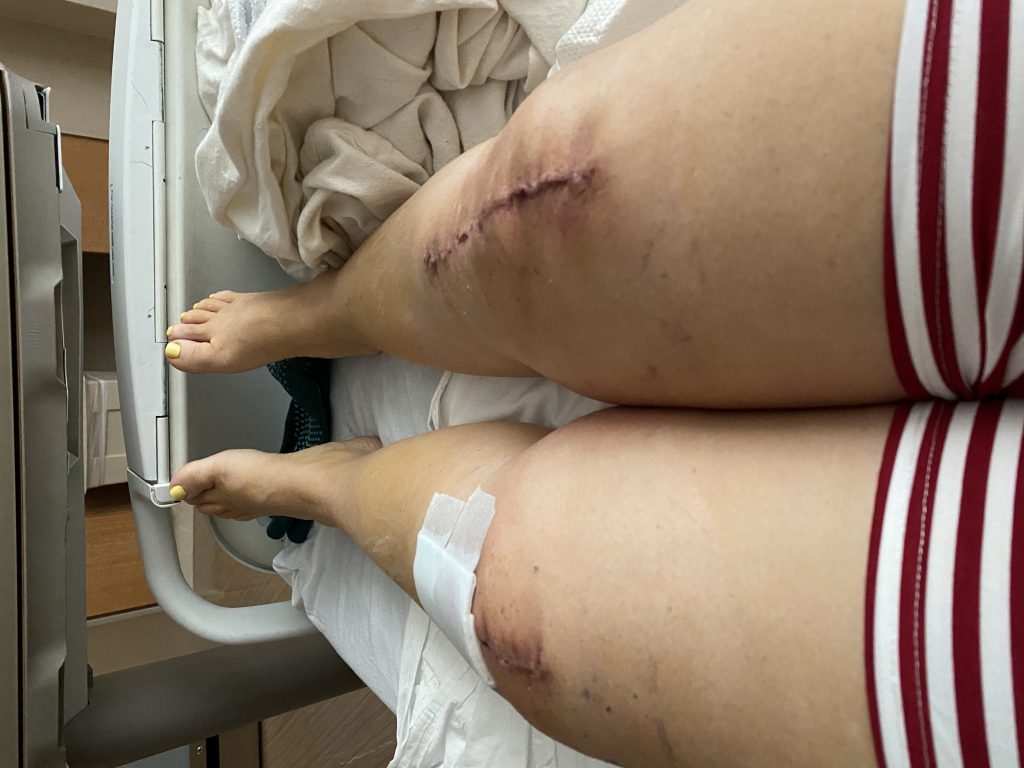 Patient image of: Norma Ruiz