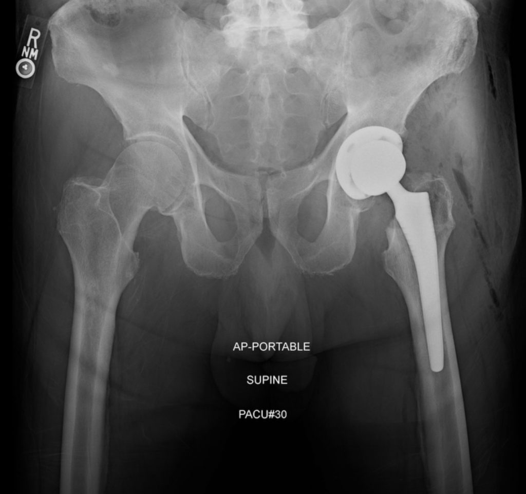 Patient image of: Samuel Gubins