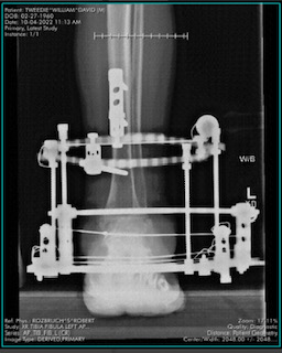 Patient image of: William Tweedie