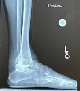 Patient image of: William Tweedie