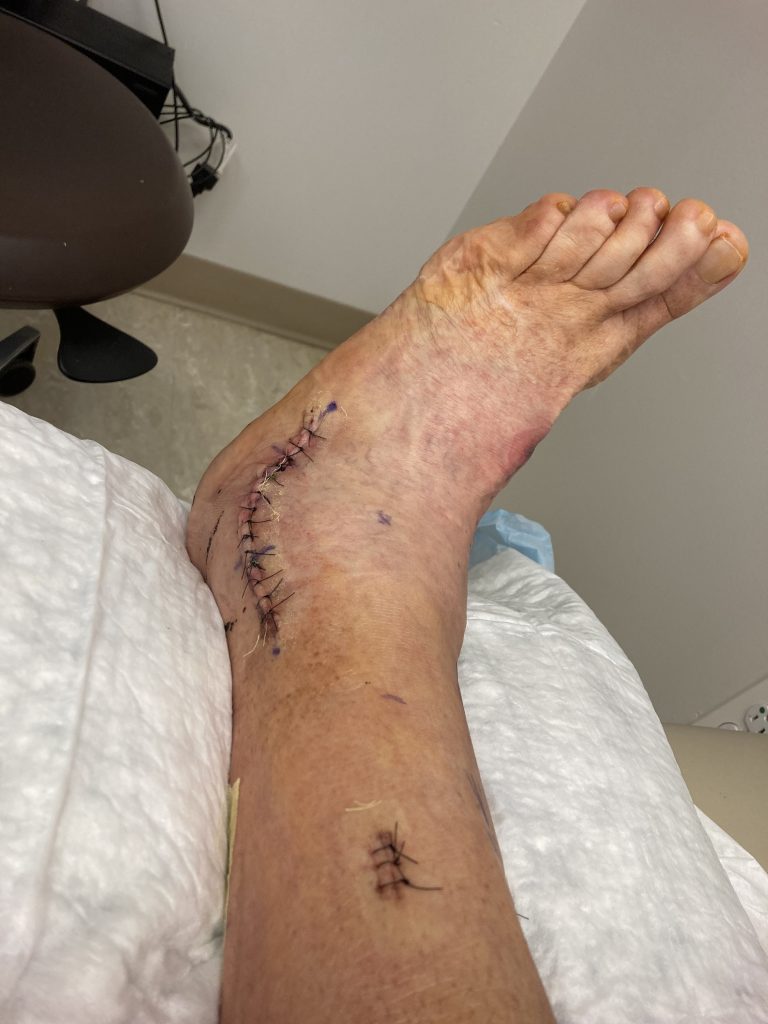 Patient image of: Kevin Pascoal