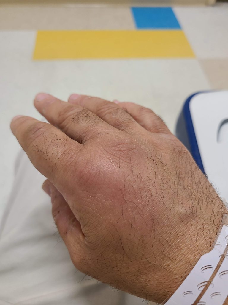 Patient image of: Élan Carmel