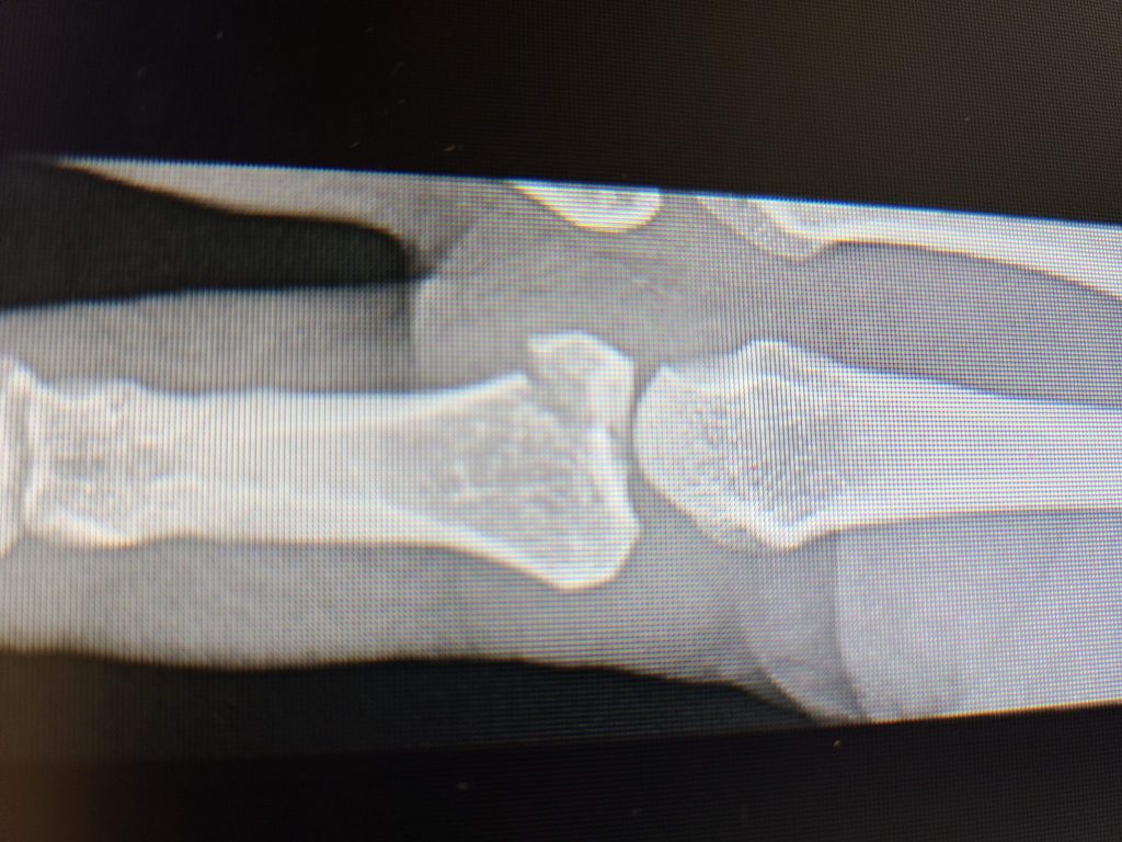 Patient image of: Élan Carmel