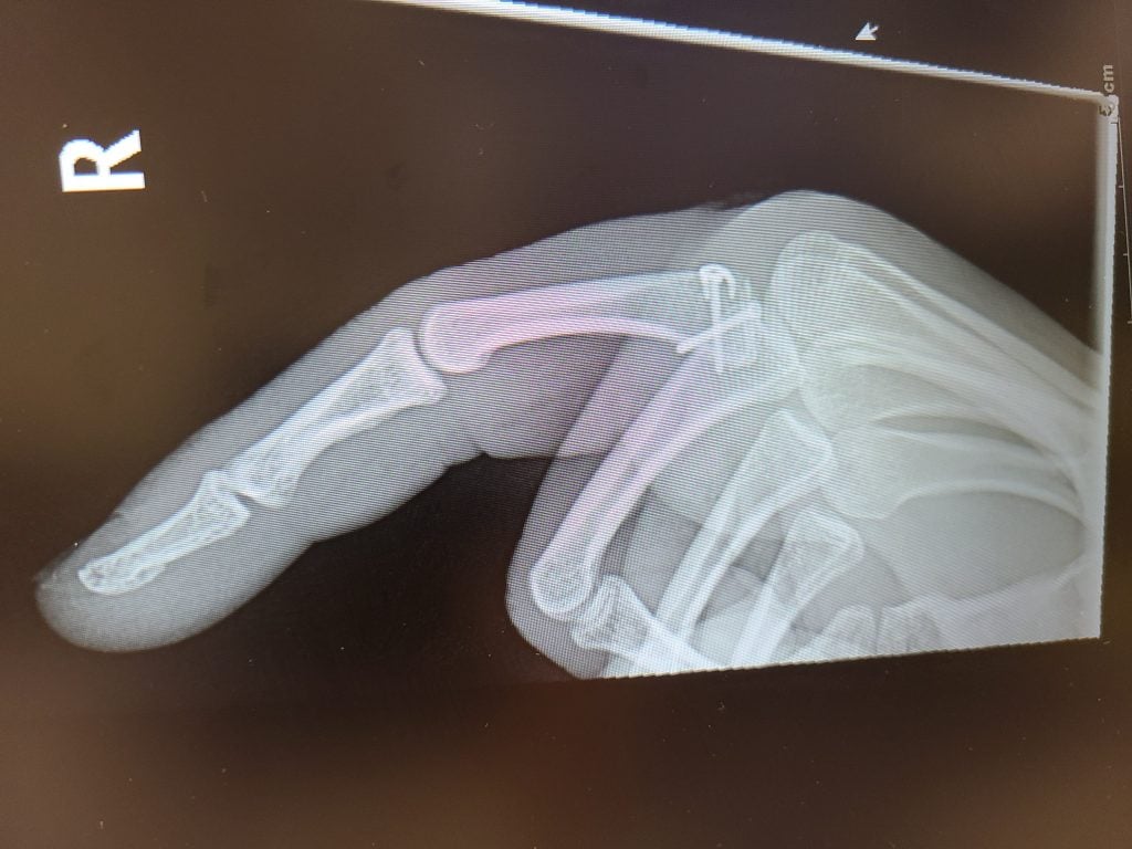 Patient image of: Élan Carmel