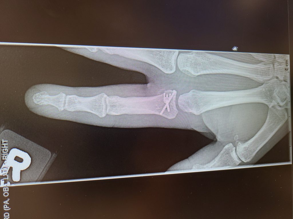 Patient image of: Élan Carmel
