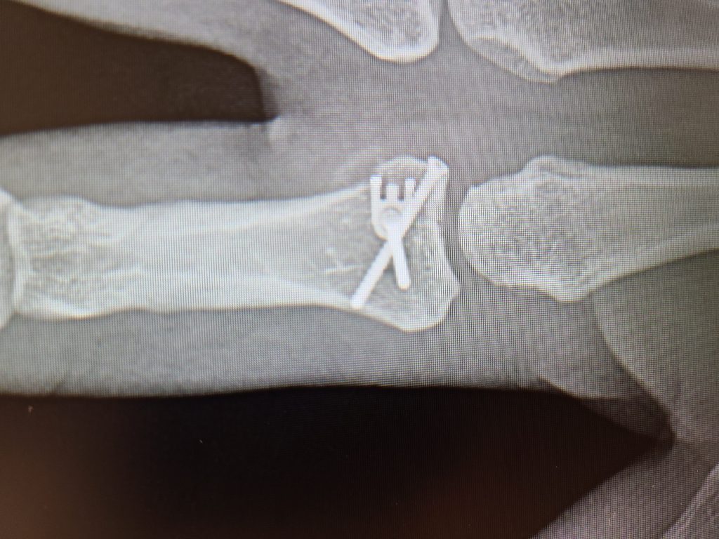 Patient image of: Élan Carmel
