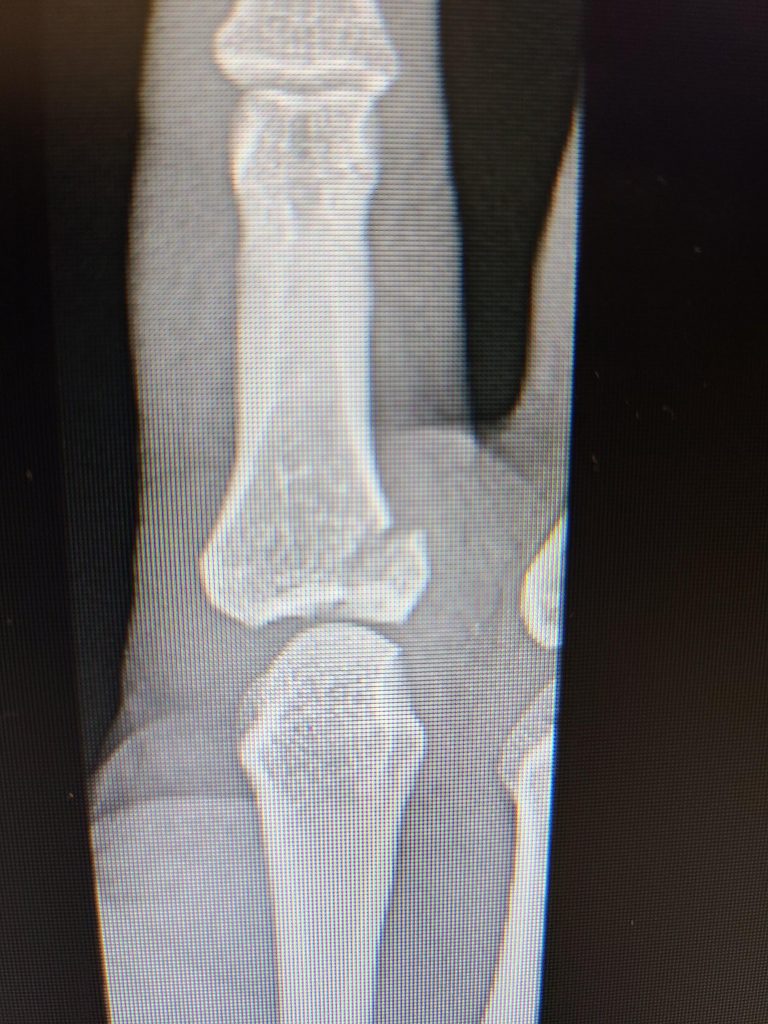 Patient image of: Élan Carmel