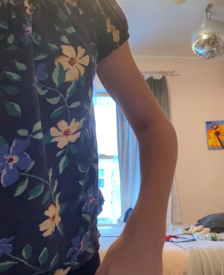 Patient image of: Hailey Pawlenko