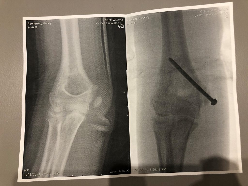 Patient image of: Hailey Pawlenko