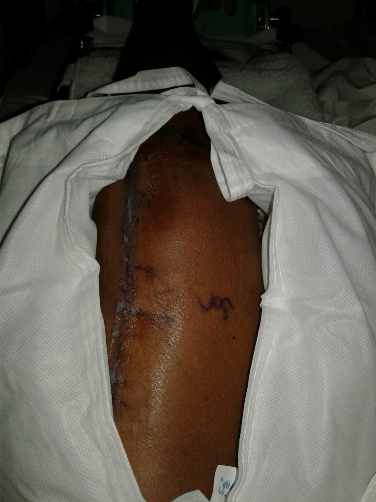 Patient image of: Valerie Bridges