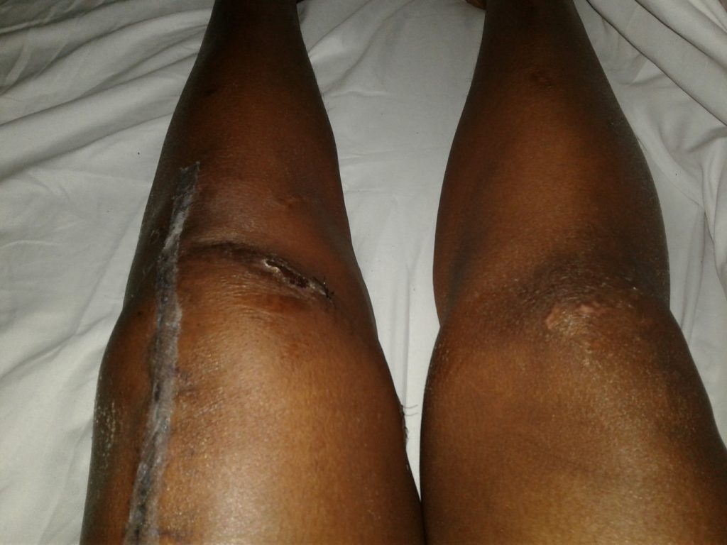 Patient image of: Valerie Bridges