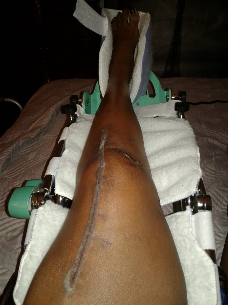 Patient image of: Valerie Bridges