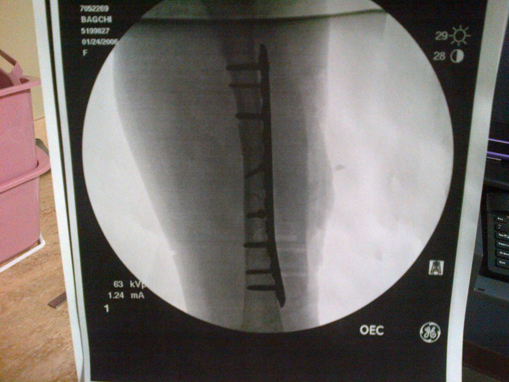 Patient image of: Caroline Madsen