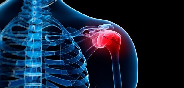shoulder pain graphic shoulder bones glowing red