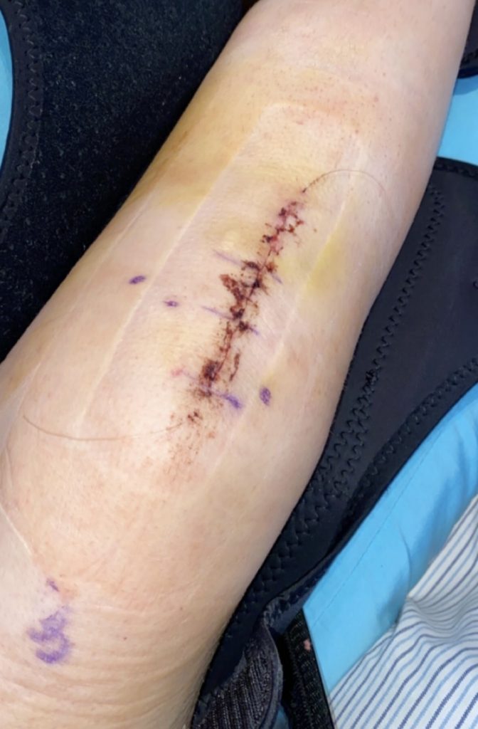 Patient image of: Elizabeth Ann McChesney
