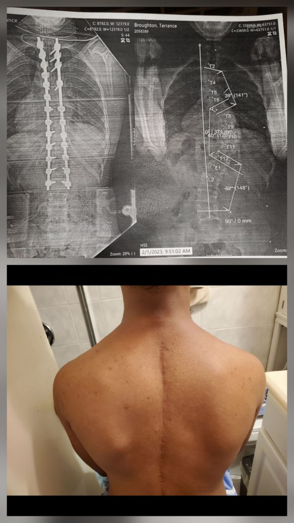 Patient image of: Terrance Broughton, Jr.