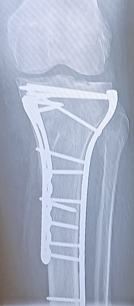 Patient image of: Roni Werner