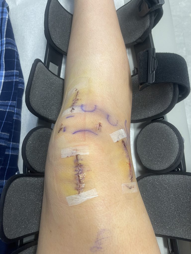 Patient image of: Ashley Hayes