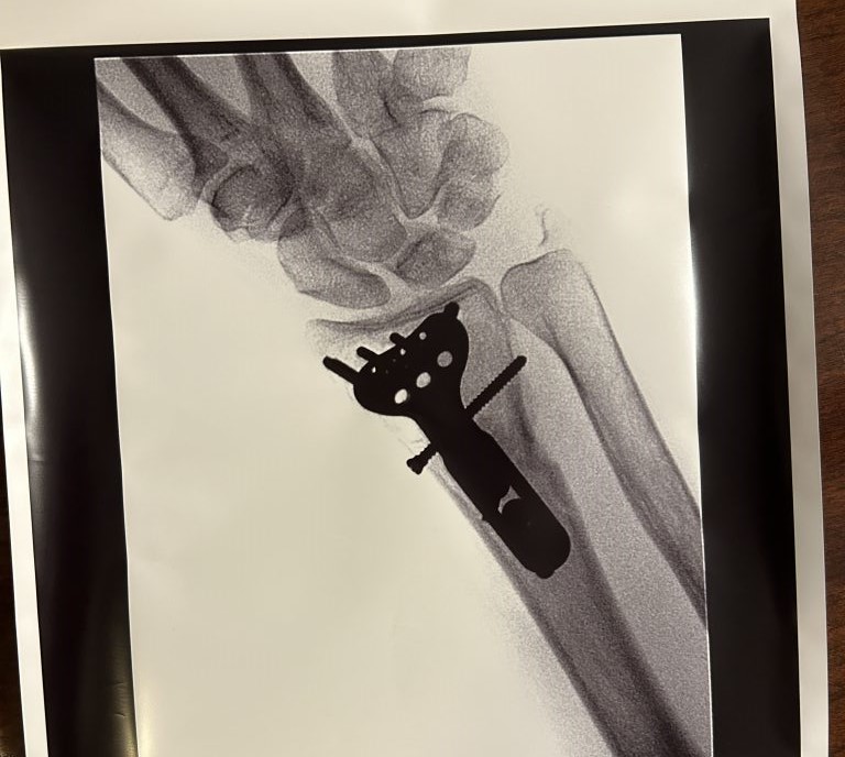 Patient image of: Lulu Murphy