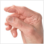 Oval 8 splint.