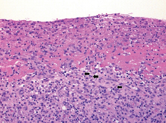 Figure 1A