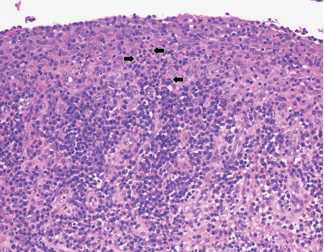 Figure 1B
