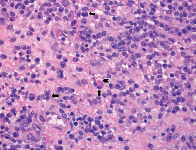 Figure 1C