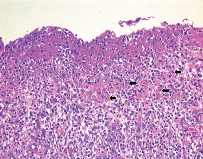 Figure 1D
