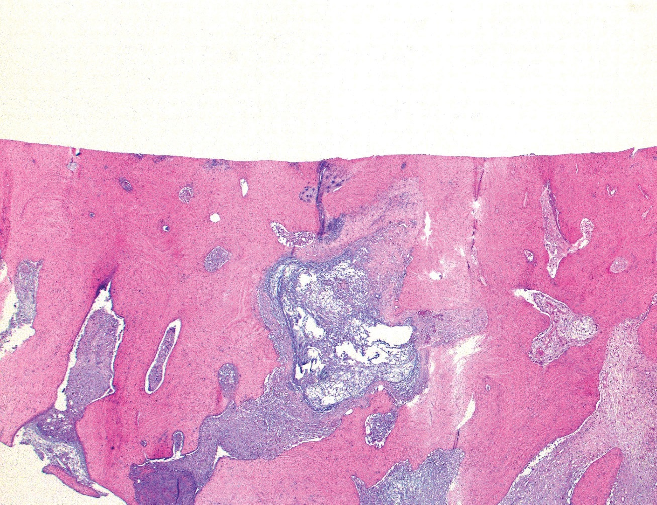 Figure 2A