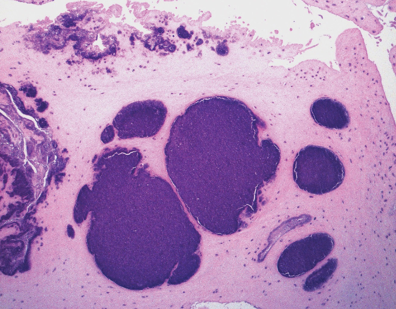 Figure 2B