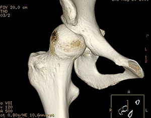 3D model created from CT scan images