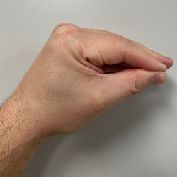 A hand in the narrowed or tear drop grasp position.