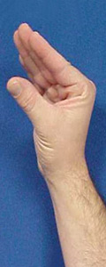 A hand in the open roof top position.