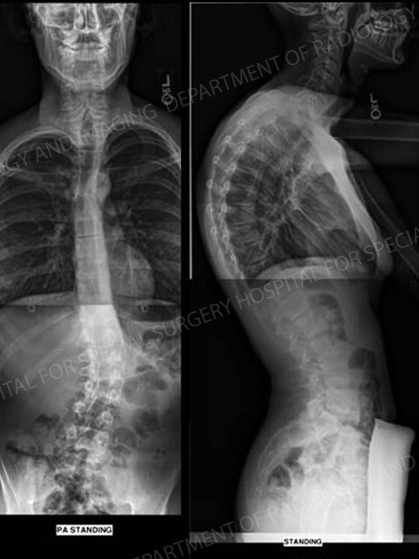 Pre-Operative x-ray images