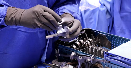 An advanced total knee replacement implant.