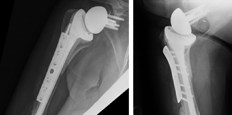 fig4