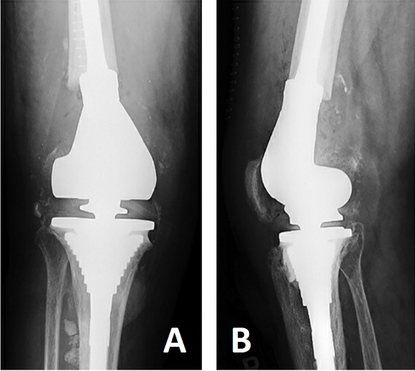 fig3
