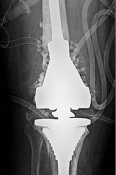 fig4