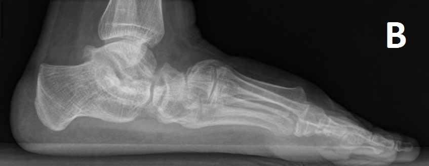 fig1b