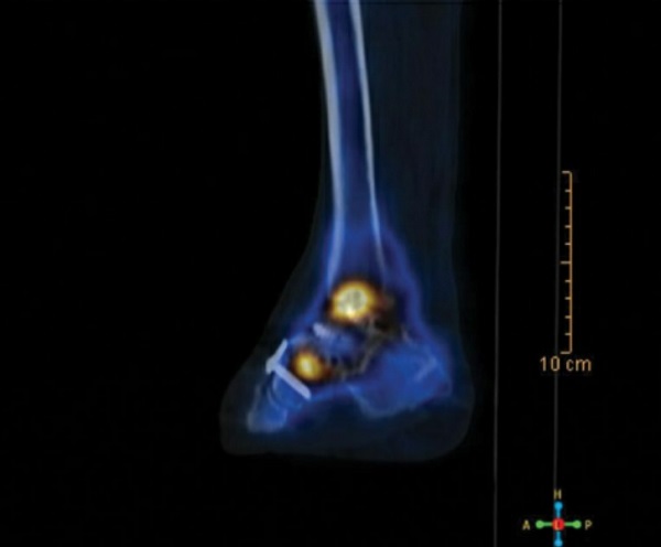 fig2