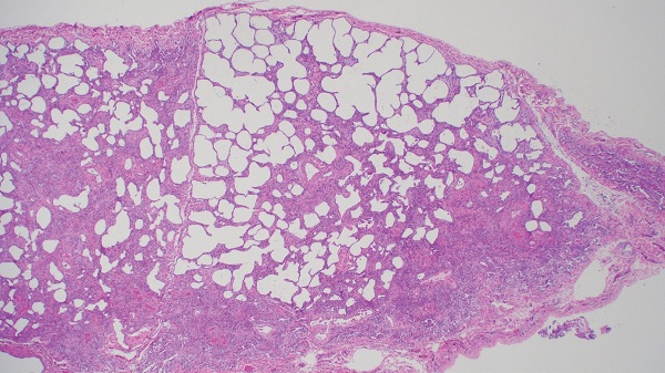 fig2