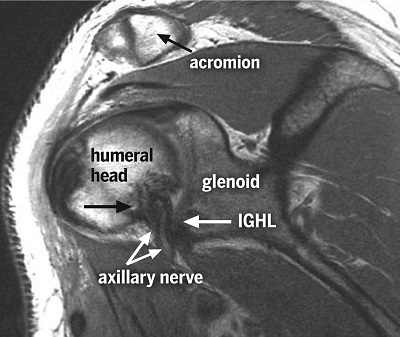 fig2