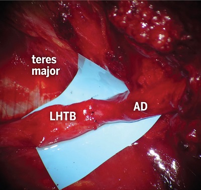 fig6